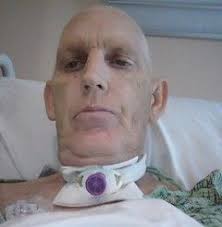 Sometimes, throat cancer looks like white patch of tissue, also known as leukoplakia. Affordable Throat Cancer Surgery Cost India Top 12 Throat Cancer Hospitals India