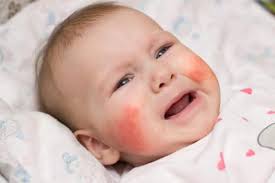 We did not find results for: Bintik Merah Pada Kulit Bayi Yang Umum Dan Harus Diwaspadai