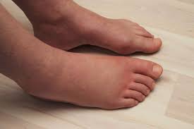 Learning how to take your blood pressure manually may take a little practice, but it is actually. How High Blood Pressure Affects Your Feet Kansas City Foot Specialists