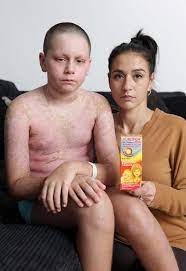 Allergic Reaction To Ibuprofen Left Boy 13 Fighting For His Life Express Co Uk