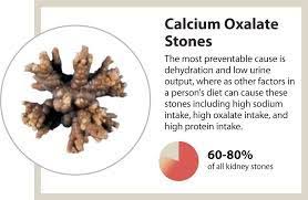 What Causes Kidney Stones