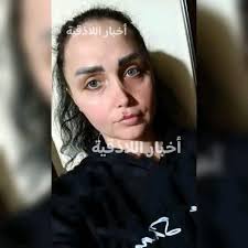 رابح/ة من المتفاعلين😍 كريم السعدان 🐵🙈 VOOX لوشن فوكس للتبييض يساعد على  إعادة صحّة بشرتك ويعطيها إشراقة طبيعيّة يساعد هذا المنتج على التخلّص من  الخلايا الميتة على سطح البشرة ليُظهر البشرة الناعمة