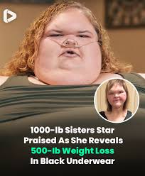 She's lost 70% of her body weight 😯