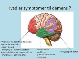 Drevne frem på stand av skammen gikk vi søderpå; Geriatri Demens Diagram Quizlet