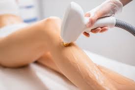 Average cost of laser hair removal: Why One Laser Hair Removal May Not Be Enough Botox Cosmetic Dermatology Coolsculpting Los Angeles Your Laser Skin Care