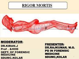 Rigor mortis starts a few hours after you die, and causes your muscles to contract, or shorten, which is their natural state. Rigor Mortis By Rajkumar Malur