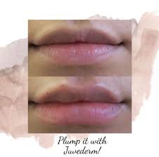 Medical aesthetics of menlo park · 885 oak grove ave. Medical Aesthetics Of Menlo Park 885 Oak Grove Ave Menlo Park Ca Medical Spas Mapquest