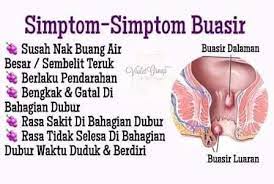 Apa kebenda tu saya pun kurang pasti. Simptom Buasir Yang Cara Kecutkan Buasir Dengan Mudah Facebook