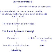 endometriosis physiopedia