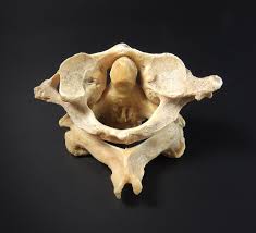 The axis is the second cervical vertebra; File Vertebra Atlas Axis Superior Jpg Wikimedia Commons