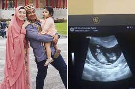 Anda biasanya tahu usia kandungan lewat usg di dokter. Usia 3 Bulan Begini Aktifnya Calon Bayi Ustaz Riza Dalam Kandungan Semua Halaman Nakita