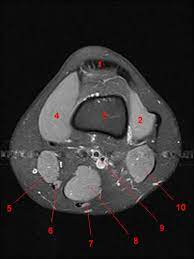 1 november 2002 mri anatomy of the knee and shoulder james y. Atlas Of Knee Mri Anatomy W Radiology