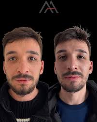 My pretty angel @meliscelikler