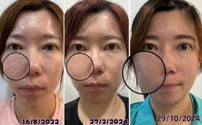 🆕新品Dokkan 日本植物酵素🇯🇵 （150粒）RM1xx  ❇️❇️融合了39种天然植物发酵物，可以有效帮助消化分解吃下去的食物，强烈吸收并包附油脂🔥🔥燃烧你的脂肪，让你在睡梦中就能健康美丽的达到目