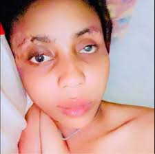 In Germany, around 20,000 people will have to leave their homes in Cologne  tomorrow following the discovery of three unexploded American World War II  bombs. http://p.dw.com/p/4vMyL