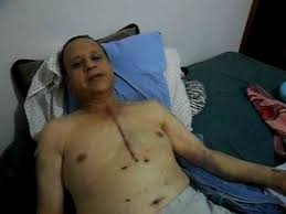Resultado de imagen para fotos de operaciones de corazon abierto