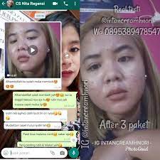 Check spelling or type a new query. Korban Cream Hn Pusat Cream Hn Original Hetty Nugrahatty