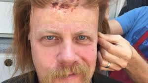 Veja como foi o processo de criação da maquiagem da morte de Abraham em The  Walking Dead