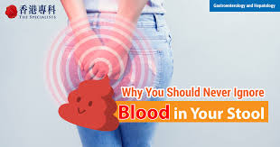 Image result for Blood in stool