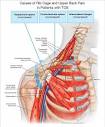 Anatomical spaces involved in TOS. | Download Scientific Diagram