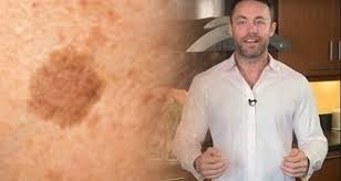 Citate despre viata trista coafuri coada de cal eleganta coafura par mediu bucle citate amuzante despre viata coafura cu bucle par lung ai pete pe maini iată explicaţia revista teo. Pete Maronii Pe Fata