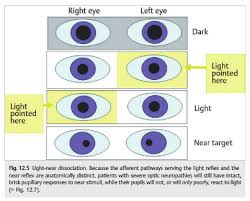 Image result for Optical Reflex