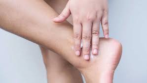 Image result for Dry Skin Management