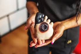 Image result for black toe diabetes