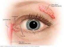 Image result for what is the treatment for dry eye syndrome
