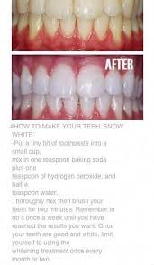 Weisse Zahne Mix 1 Teeloffel Backpulver 1 2 Teeloffel Wasserstoffperoxid 1 2 Teeloffel Was Hydrogen Peroxide Brushing Teeth Baking Soda