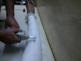 صور رجل مجبسه الفرق بين الجبس الابيض والجبس البلاستيكى كيوت