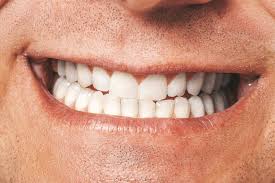 As dental technology has advanced over the. Closeup Of Male Mouth Healthy Smile Flip 2019 Creative Commons Bilder