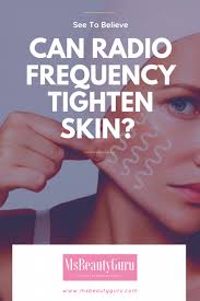 Radio Frequency Skin Tightening All Benefits You Need To Know Ms Beauty Guru
