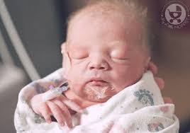 Image result for Preterm Infant Growth
