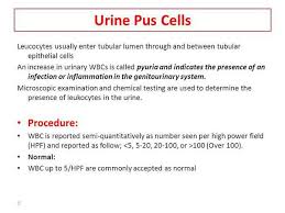 What Does It Mean When My Urine Has 8-10 Pus Cells And 4-6 Epithelial Cells?  - Quora