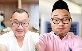 Hilang 52 Kilogram Selepas Jalani Pembedahan, Michael Ang Tak Suka  Penampilan Terkini