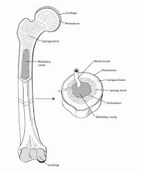 Image result for Osteosarcoma