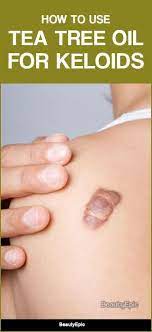 How To Use Tea Tree Oil For Keloids Tea Tree Oil Tree Oil Tea Tree
