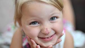 Connie is haar 'clownsneusje' kwijt