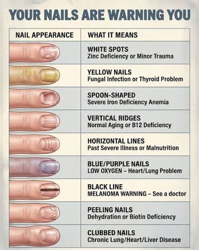 Warning Sign About Nail You Should Never Ignore Your nails can reflect  systemic health changes before lab results shift. Recognizing patterns early  helps guide proper clinical testing and interpretation. Key Nail Signs