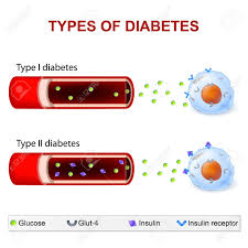 Without insulin, cells cannot take in glucose. Arten Von Diabetes Typ 1 Und Typ 2 Diabetes Mellitus Insulin Abhangige Diabetes Mellitus Und Nicht Insulinabhangiger Diabetes Mellitus Insulinresistenz Und Eine Unzureichende Insulinproduktion Lizenzfrei Nutzbare Vektorgrafiken Clip Arts