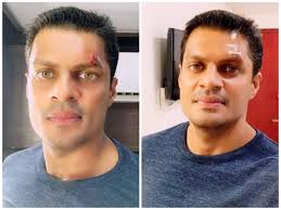 We have seen sudev nair stepping into the shoes of characters and charming us with his acting chops. Sudev Nair Sudev Nair Gets Injured During A Stunt Malayalam Movie News Times Of India