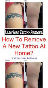 Yag Laser Tattoo Removal Permanent Tattoo Removal Cost How Well Does Tattoo Laser Removal Work Tattoo R Tattoo Removal Cost Tattoo Removal Cream Laser Tattoo