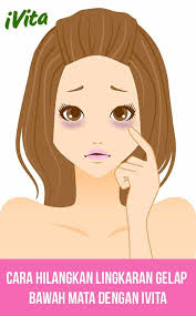 Beberapa cara efektif menghilangkan mata sembab setelah menangis: Mata Lebam Posts Facebook
