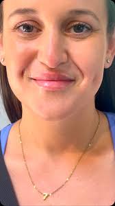 Christine Bateman, MSN, FNP-BC (@injector_tine) • Instagram photos and  videos