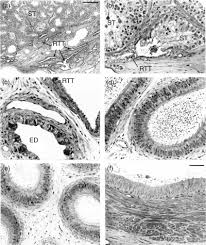 How to draw a cat's eye. Epididymis An Overview Sciencedirect Topics