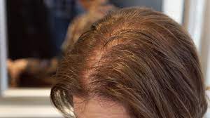 Short haircut's the best for thin hair. Hairstyles For Thin Hair To Try Now