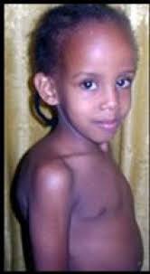 Snellville Nonprofit Sends Somalia Relief, Hope