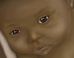 Newborn Jaundice Projects :: Photos, videos, logos, illustrations and  branding :: Behance