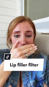 Thin Lips vs. Lip Filler Filter: A Comparison